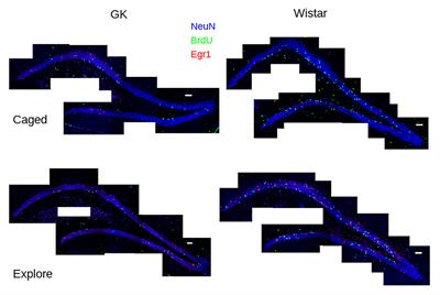 Functional Integration of Adult-Generated Neurons in Diabetic Goto-Kakizaki Rats